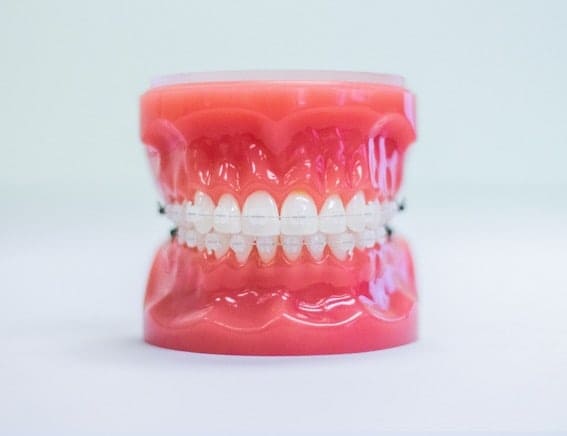 clear braces port orchard
