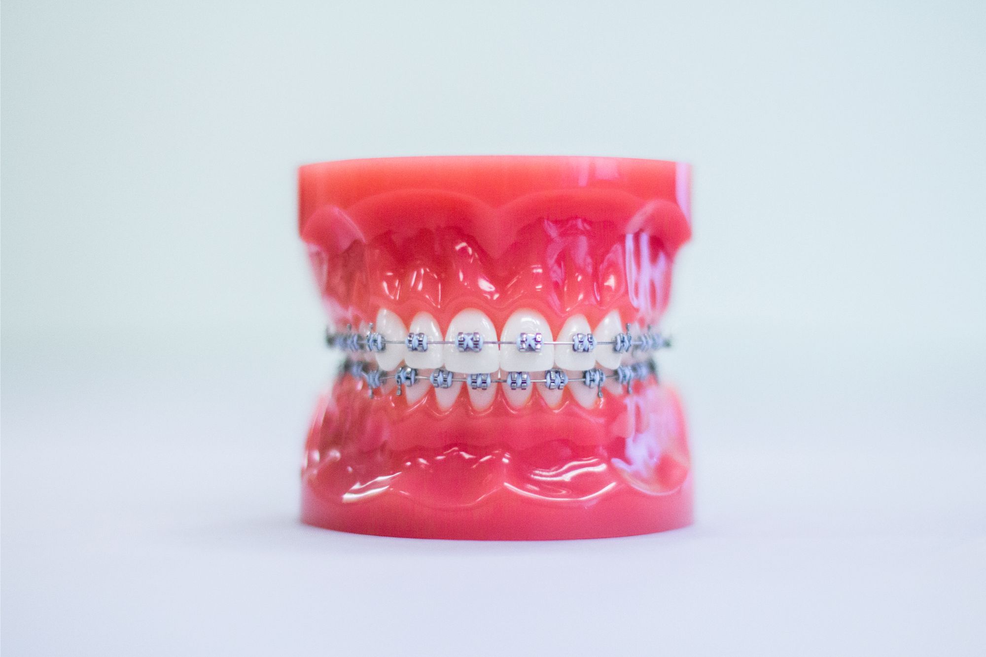 metal braces port orchard